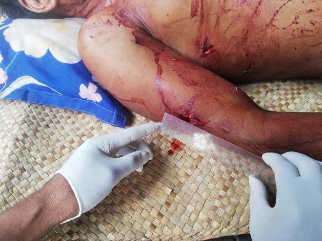 បុរសចំណាស់ម្នាក់បានស្លាប់ និង ២នាក់ទៀតរងរបួសដោយសារមនុស្សឡប់សតិចាក់នឹងកាំបិតចិតបន្លែ