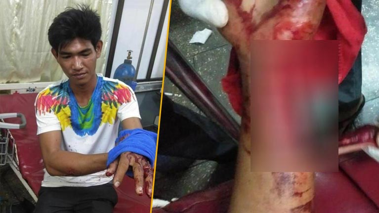 យុវជនម្នាក់ត្រូវក្រុមស្ទាវលើកគ្នាមកកាប់ស្ទើរដាច់ដៃ