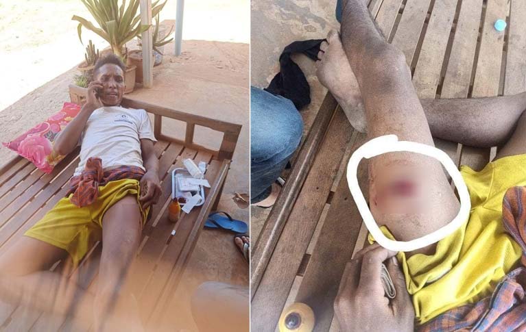 មន្ត្រីបរិស្ថានបាញ់ប្រហារពលរដ្ឋលួចអារឈើក្នុងដែនអភិរក្សព្រៃអង់តែនថាជាសិទ្ធិការពារខ្លួន